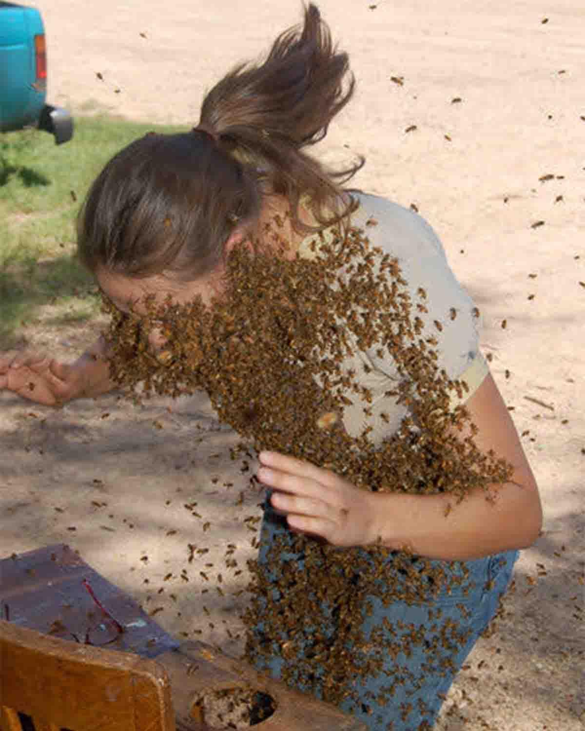 stung by bees